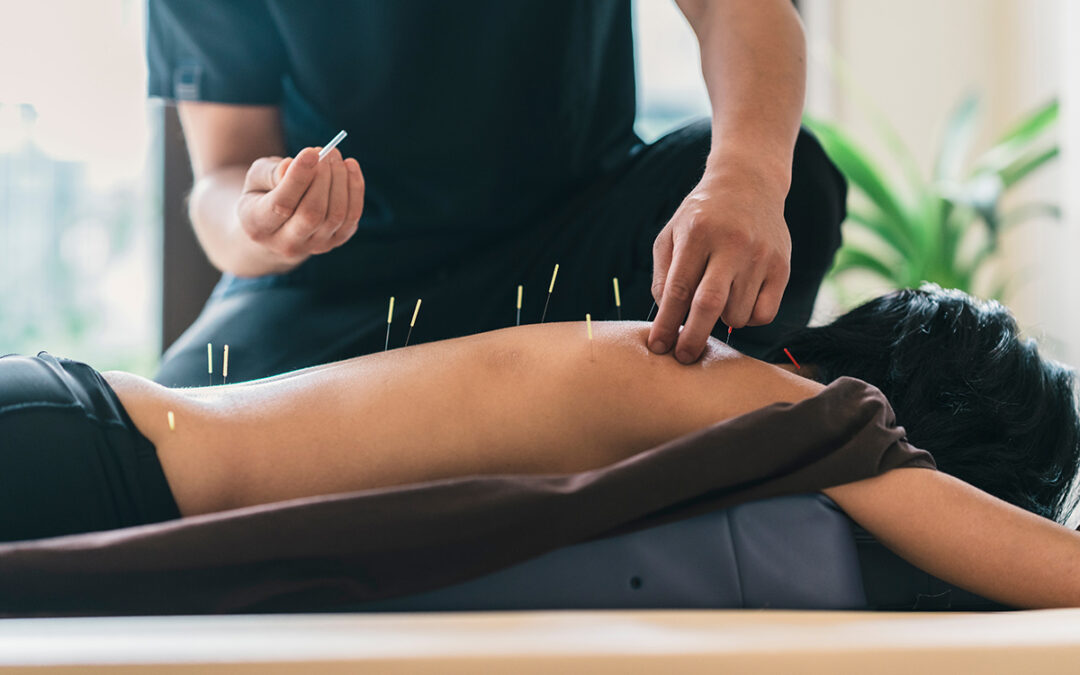 How Acupuncture Works